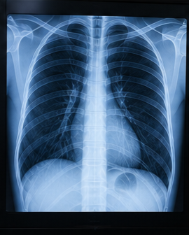 X-Ray Service at Krivaa's Diagnostics Thane West